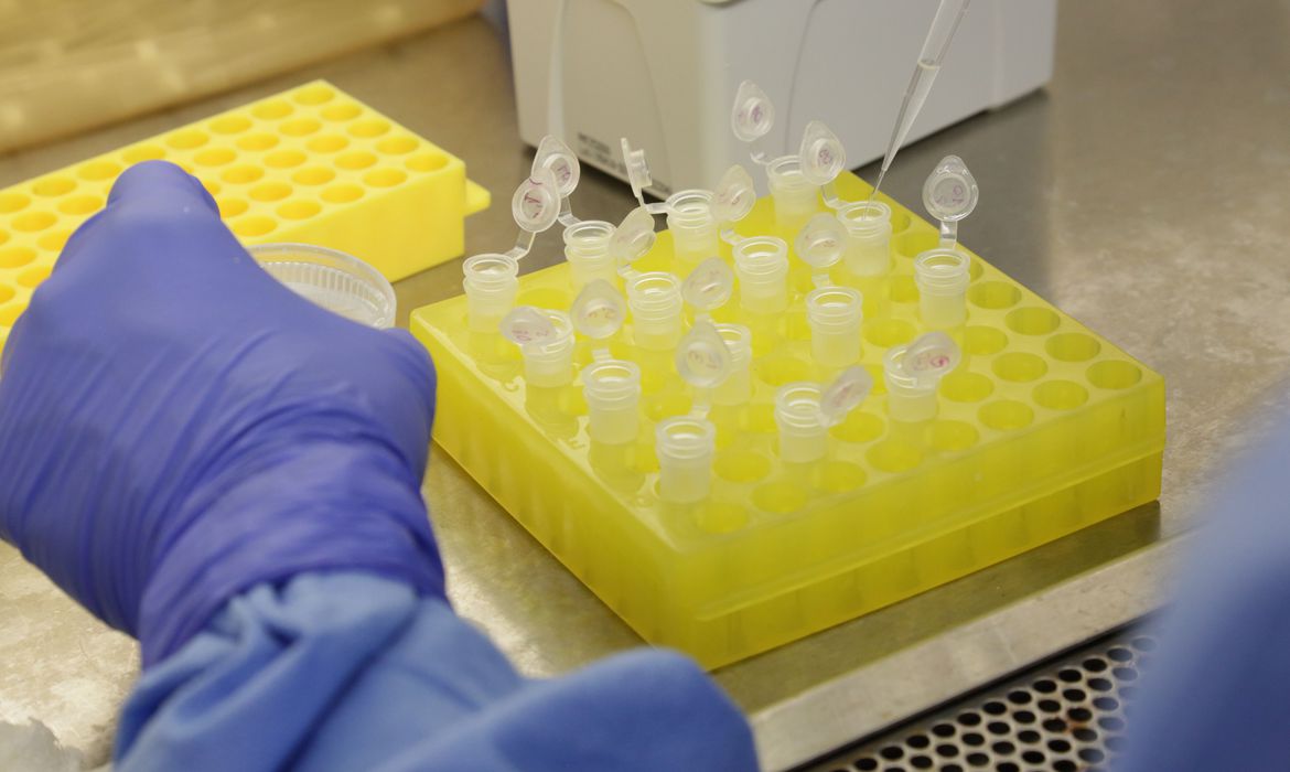 diagnostico_laboratorial_de_casos_suspeitos_do_novo_coronavirus_2801209411