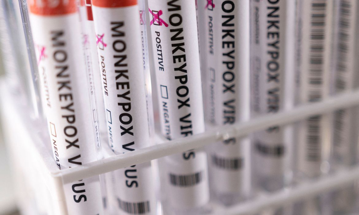2022-05-23t222423z_1_lynxnpei4m100_rtroptp_4_health-monkeypox_1