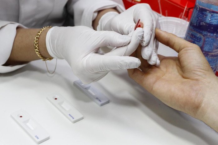 Exames laboratoriais são importantes para a confirmação das ISTs