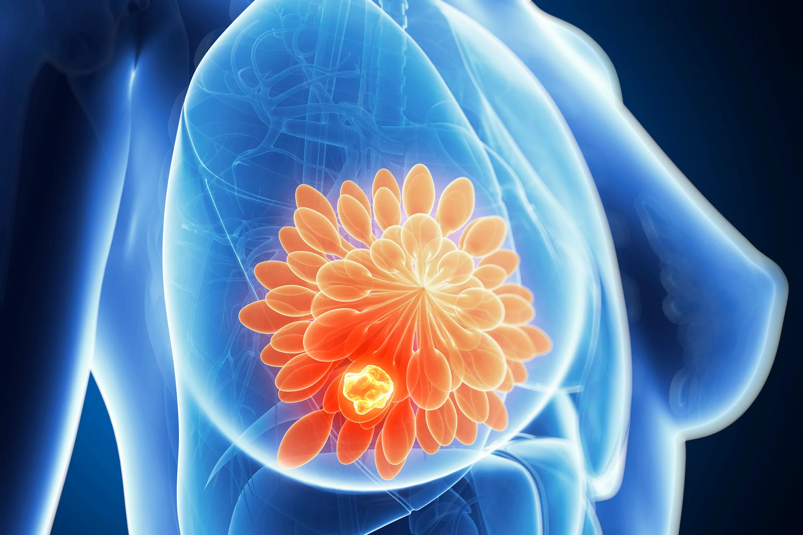 saude-cancer-de-mama-20141126-001