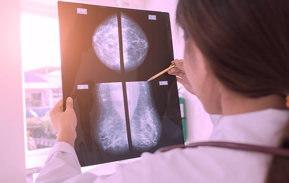 Mulheres acima de 40 anos devem fazer exames periódicos de mamografiaafia-precisam-pressionar-as-mamas-17-10-info-mamografia-site