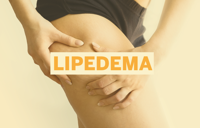 LIPEDEMA (1)